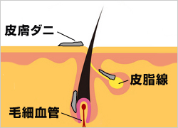 抜け毛の原因 抜け毛の原因